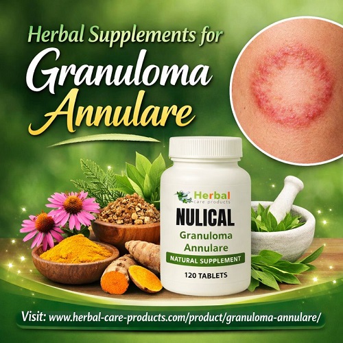 Herbal Supplements for Granuloma Annulare.jpg